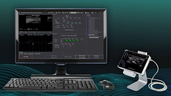 InSight NCS - Elite with Integrated NMUS 800x450