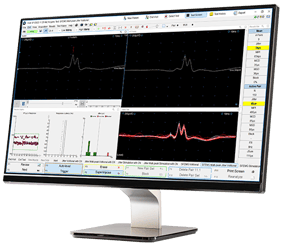 Natus Elite Software on Monitor Main Image